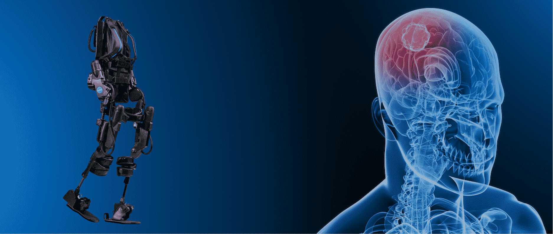 How Exoskeletons Are Beneficial for Acquired Brain Injuries