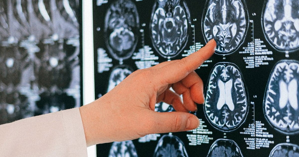 Innovation in Neurorehab